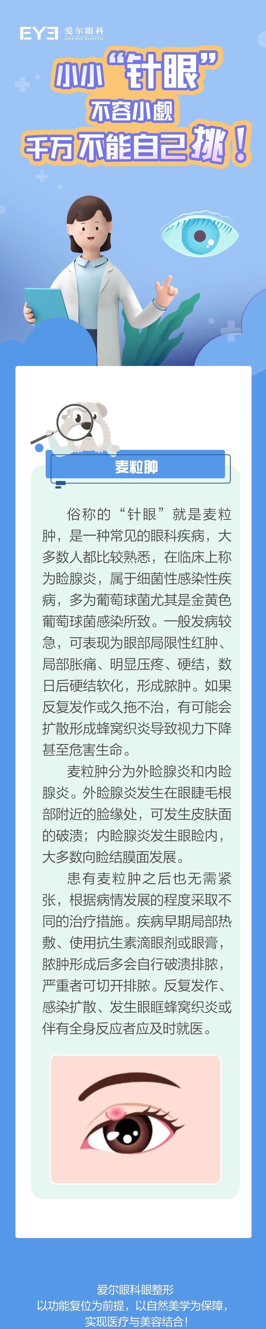 麦粒肿.jpg