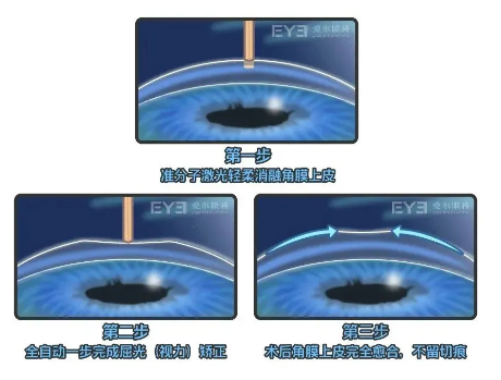 640 (3).png