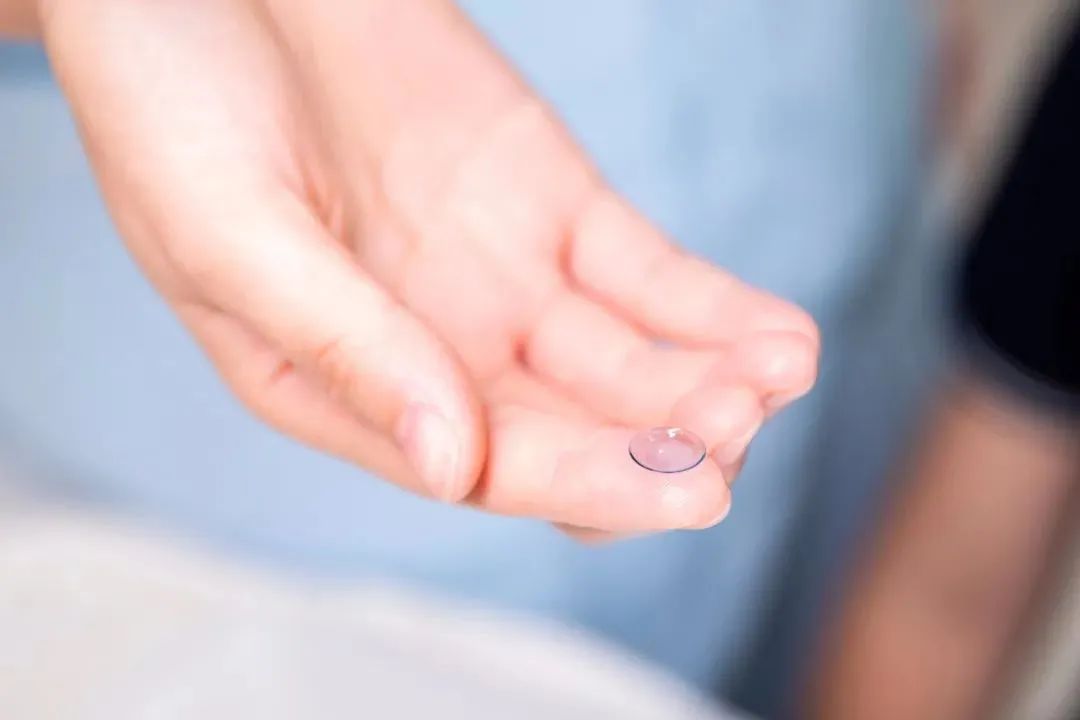 一副角膜塑形镜到底可以戴几年?(图1) 一副角膜塑形镜到底可以戴几年?(图1)